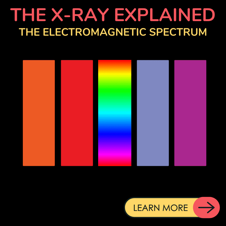 ps x-ray explained
